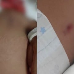 Crian&ccedil;a de 3 anos foi atingida com dois tiros. Foto: Reprodu&ccedil;&atilde;o/TV Vit&oacute;ria.