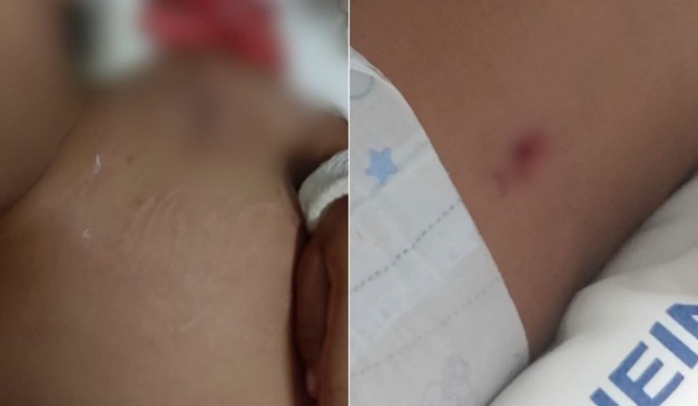 Criança de 3 anos foi atingida com dois tiros. Foto: Reprodução/TV Vitória.