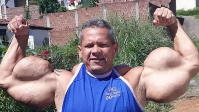 Arlindo de Souza, o "Montanha", também conhecido como o "Popeye brasileiro" Imagem: Reprodução/Facebook @arlindoanomalia