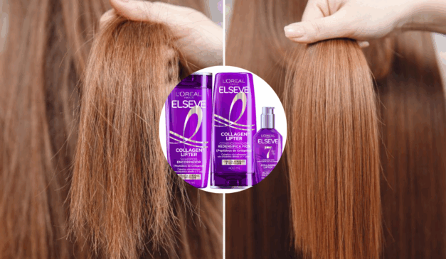 Foto: Reprodução / Elseve