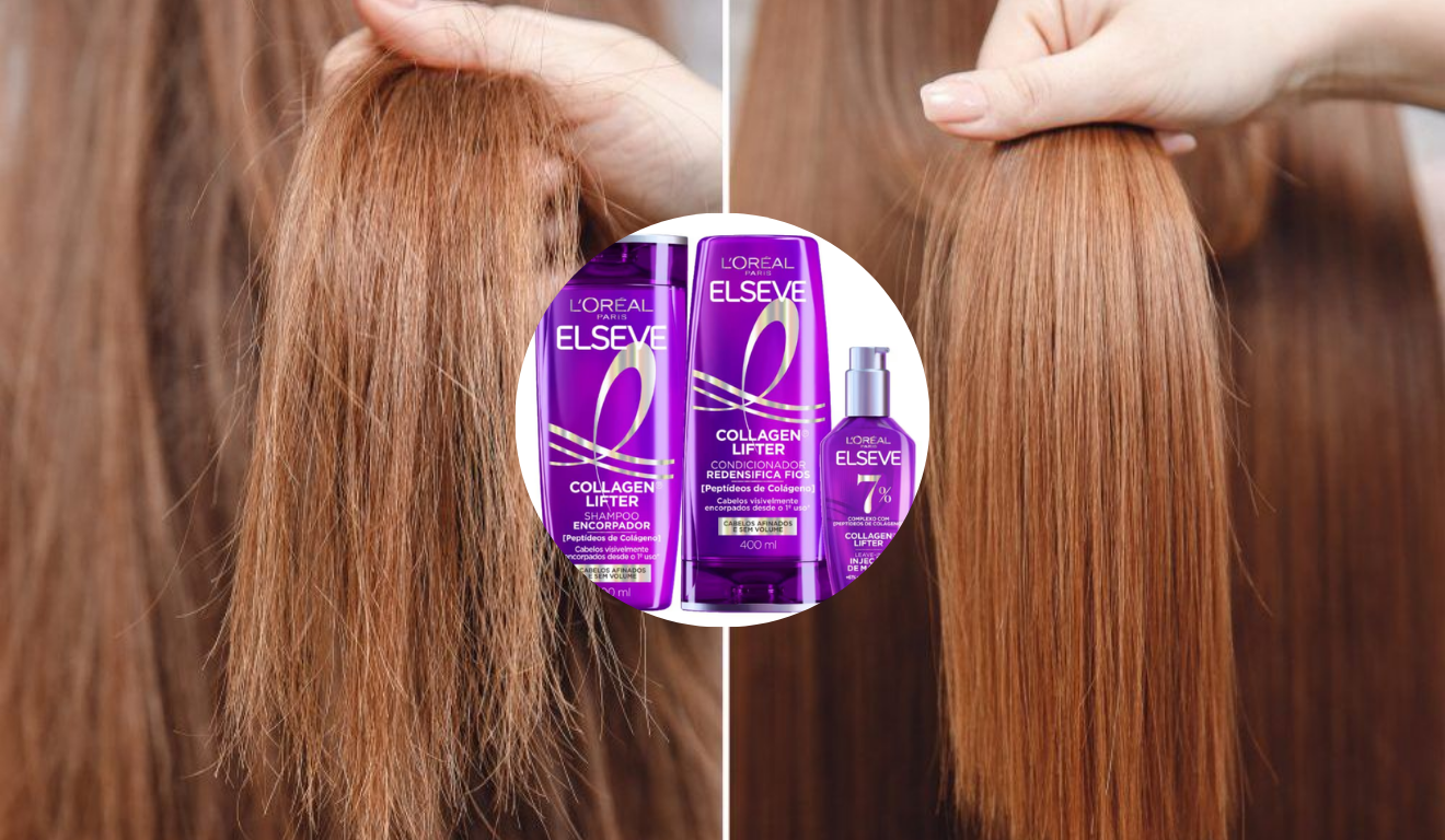 Foto: Reprodução / Elseve Foto: Reprodução / Elseve