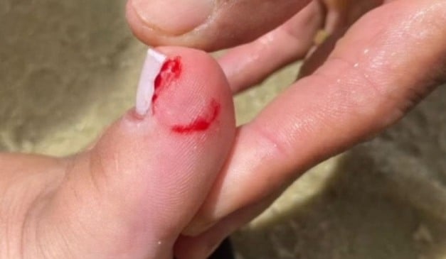 Foto: Reprodução/TV Vitória