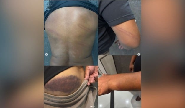 Ex-jogador Perdigão agredido é por PMs após jogo do Campeonato Paranaense