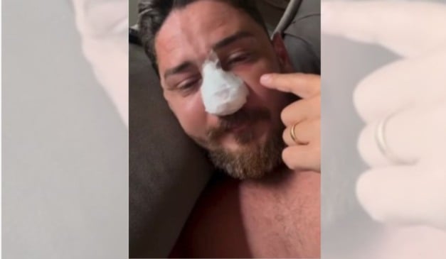 Jhonny Andrade passou por cirurgia para reparar fraturas no rosto. Foto: Reprodução/Instagram/@johnnyandradepersonal