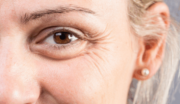 Ingrediente que suaviza as rugas/Canva