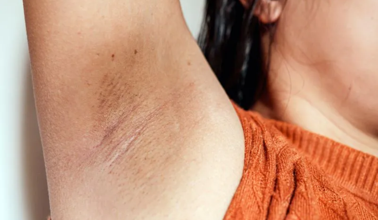 Foto: Reprodução Foto: Reprodução