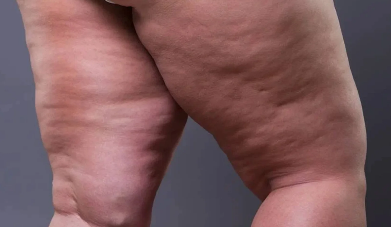 Foto: Reprodução Foto: Reprodução