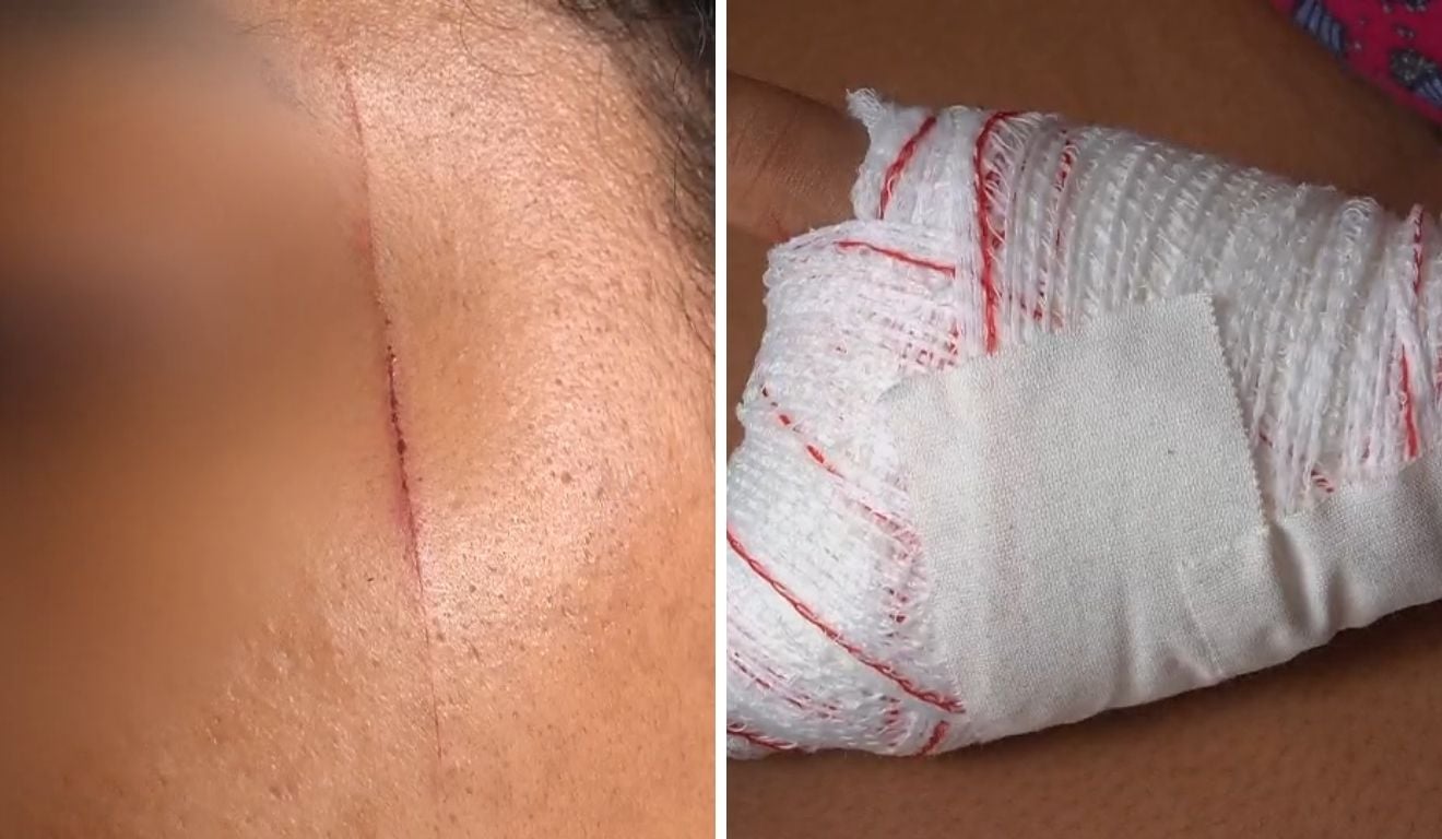 Mãe reage a tentativa de assalto e impede ataque contra filhos na Serra