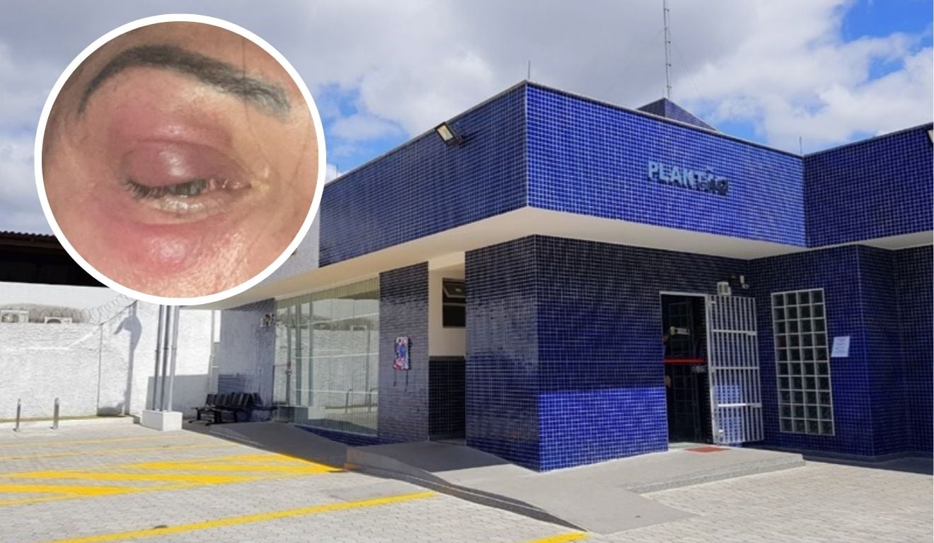 Policial penal denuncia agressão de namorado em Vila Velha e pede medida protetiva
