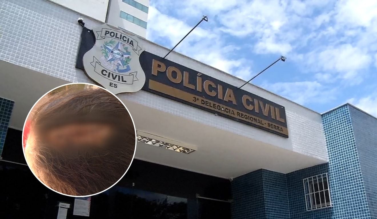 Mulher é agredida com golpes de ripa após pedir que marido parasse de usar drogas na Serra