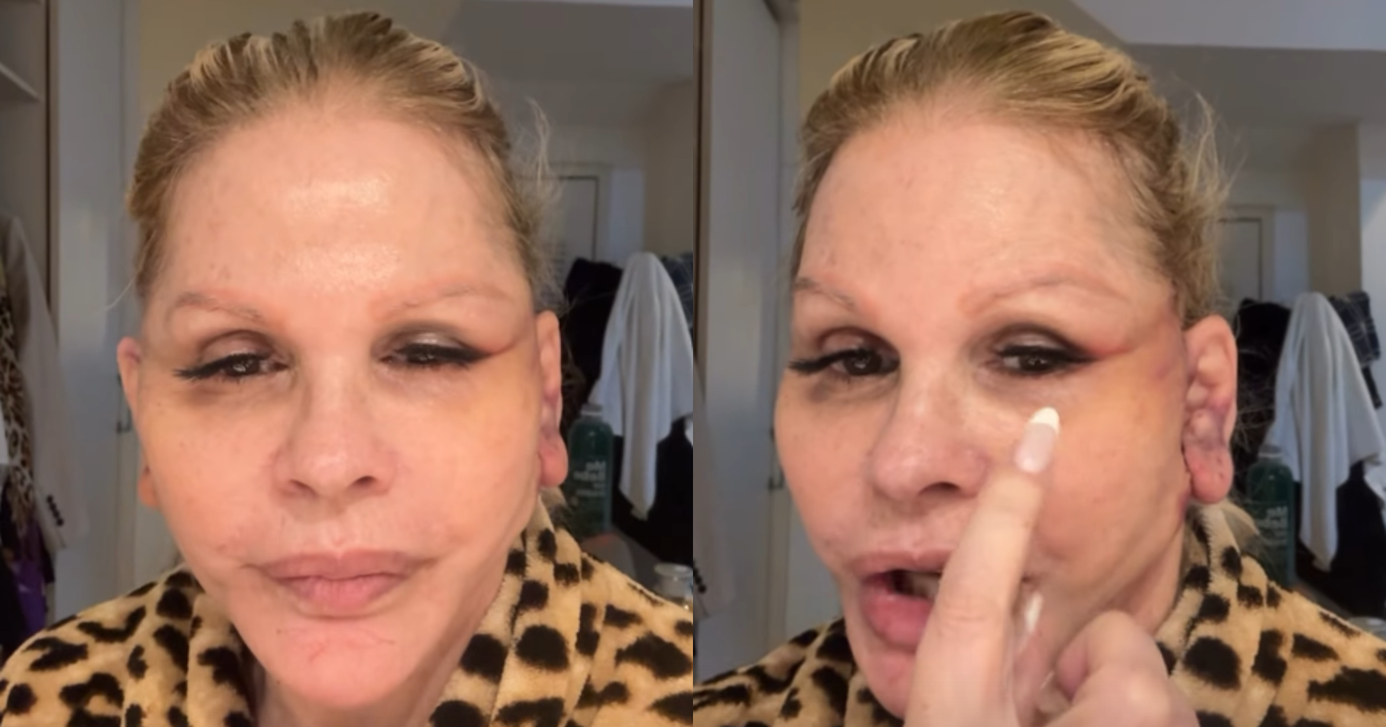 Monique Evans faz cirurgia para rejuvenescer o rosto e surge irreconhecível: “Nem o banco” - QTU Questões do Universo