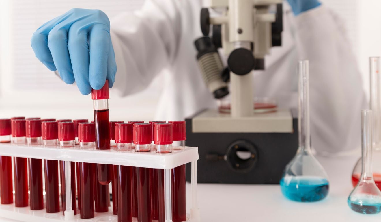 Exame de sangue para identificar Alzheimer: como funciona? Quem pode fazer?