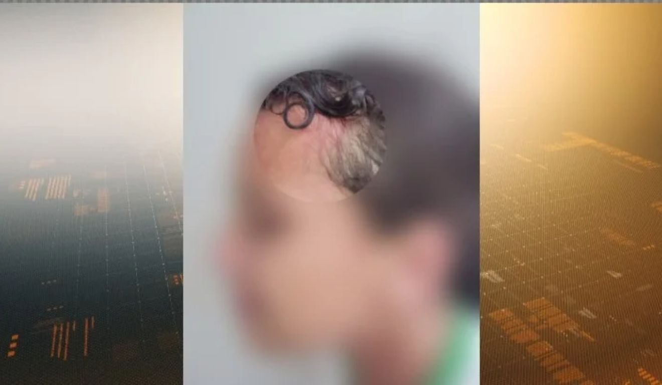Menina de 12 anos é atacada a marteladas por colega de sala em Cariacica