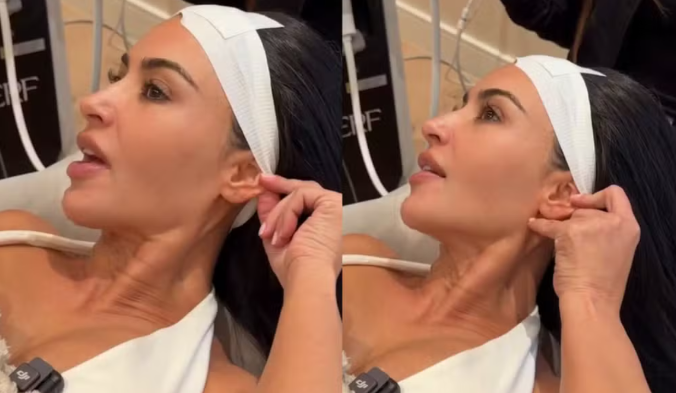 “Não sei se devo” — Kim Kardashian revela procedimento queridinho dos famosos e choca